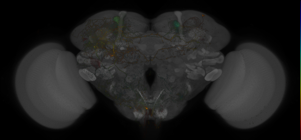 JRC_MB304B_Brain_20170829_34_A2_20x