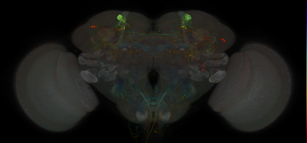 JRC_MB304B_Brain_20170829_34_A4_20x