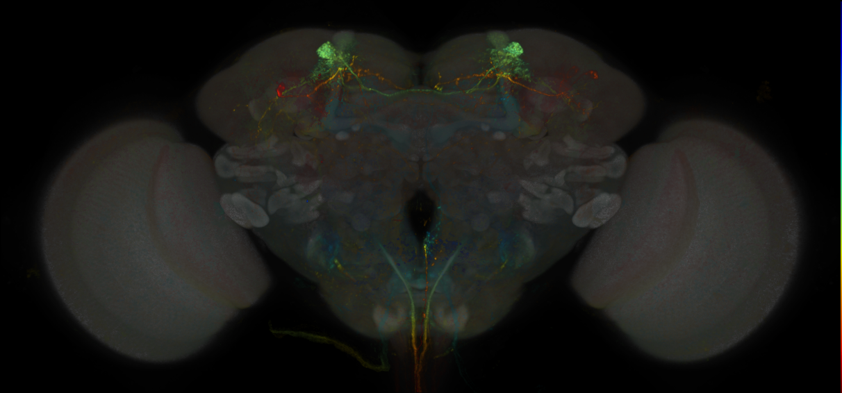 JRC_MB304B_Brain_20170829_34_A6_20x