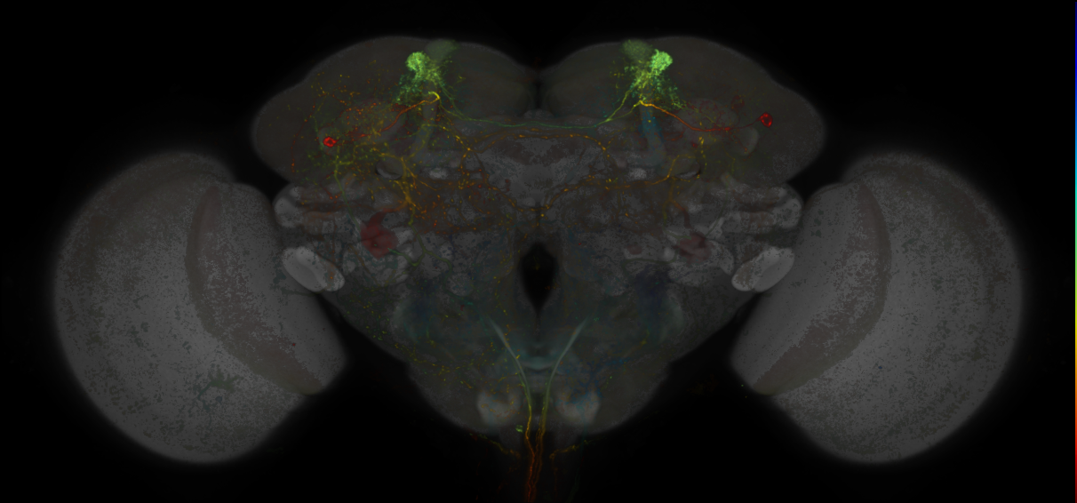 JRC_MB304B_Brain_20170829_34_B1_20x