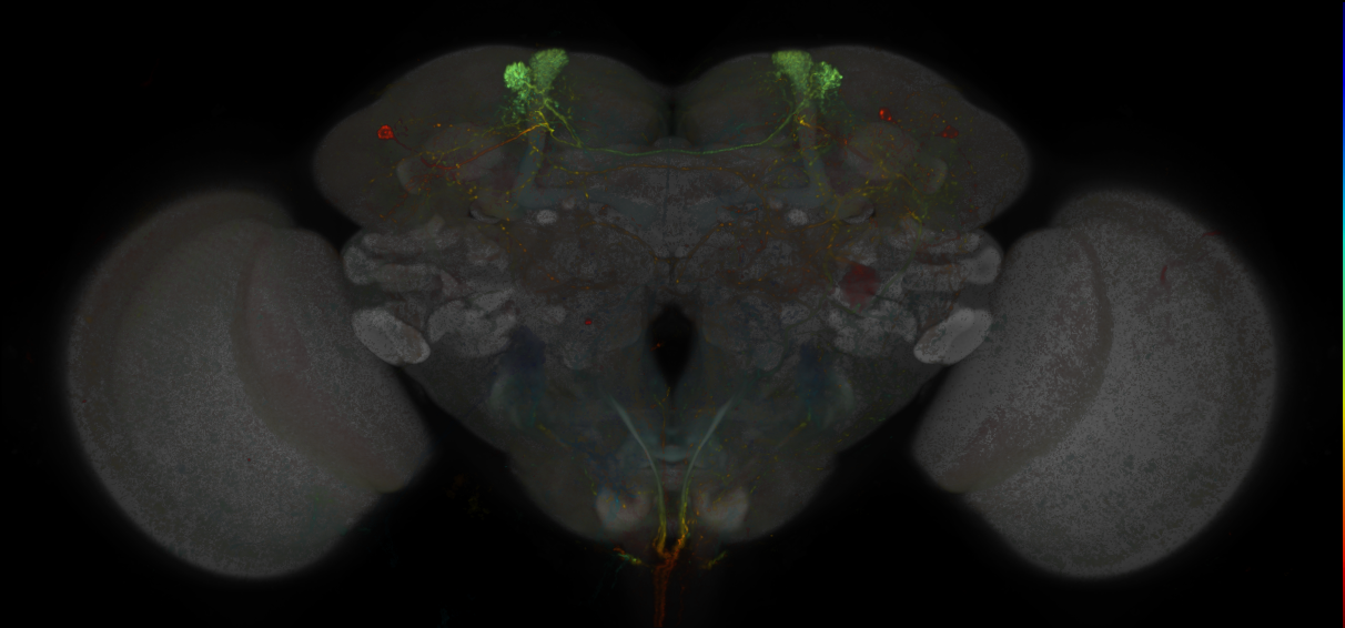 JRC_MB304B_Brain_20170829_34_B2_20x