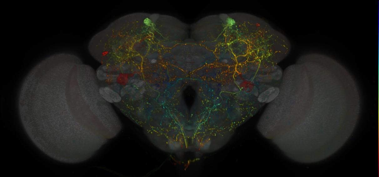 JRC_MB304B_Brain_20170829_34_B3_20x