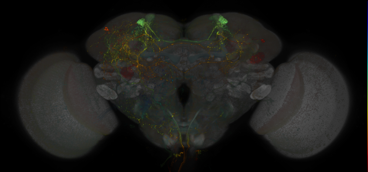 JRC_MB304B_Brain_20170829_34_B4_20x