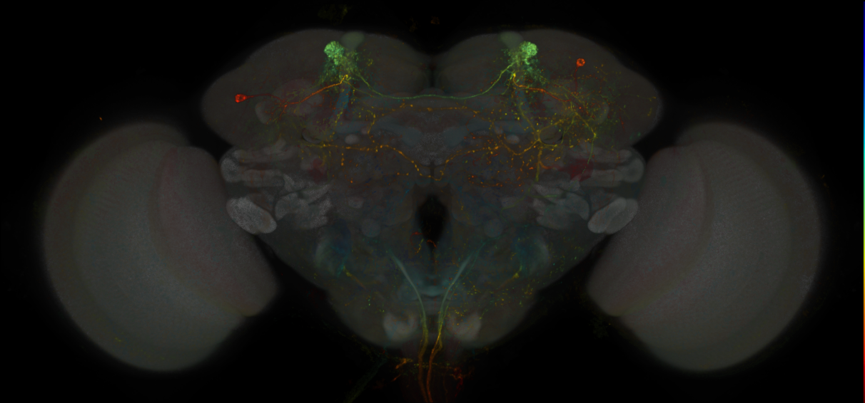 JRC_MB304B_Brain_20170829_34_B5_20x