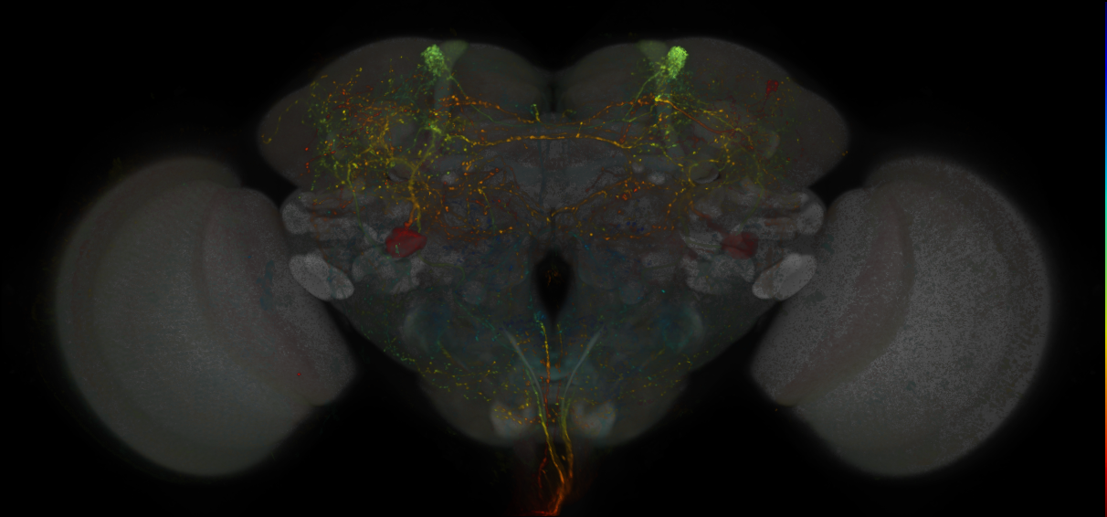 JRC_MB304B_Brain_20170829_34_B6_20x