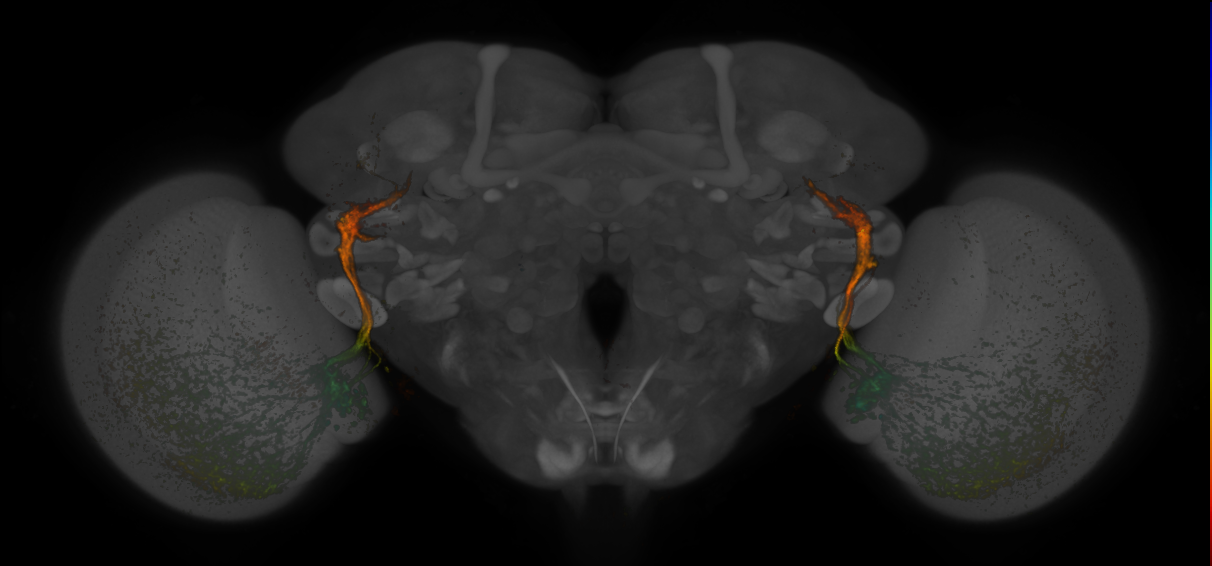 JRC_MB425B_Brain_20170829_34_C2_20x