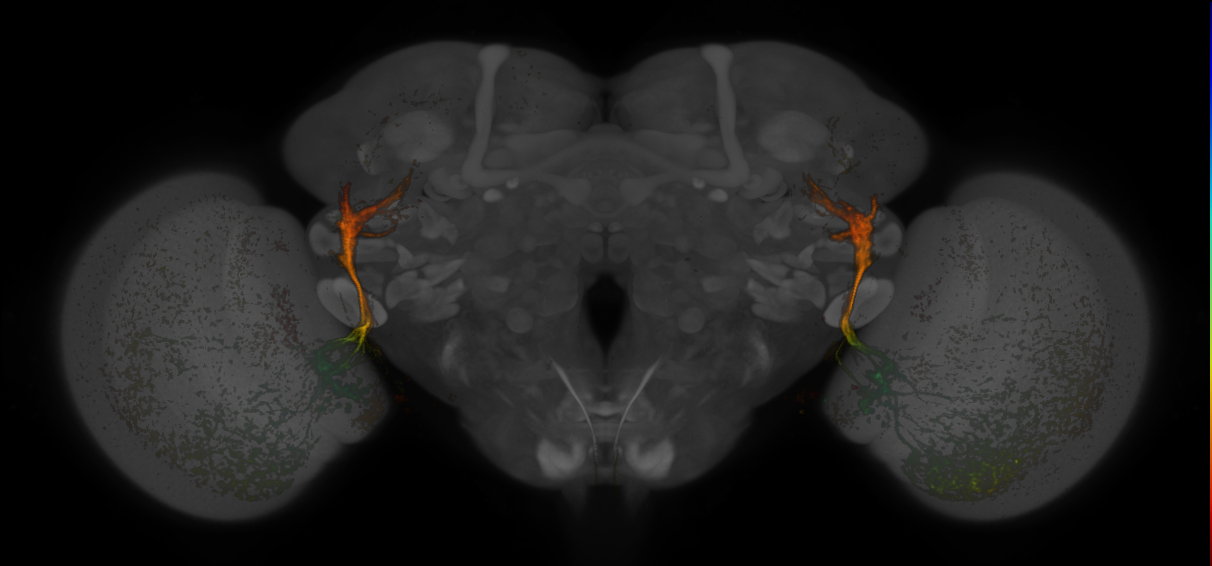 JRC_MB425B_Brain_20170829_34_C5_20x