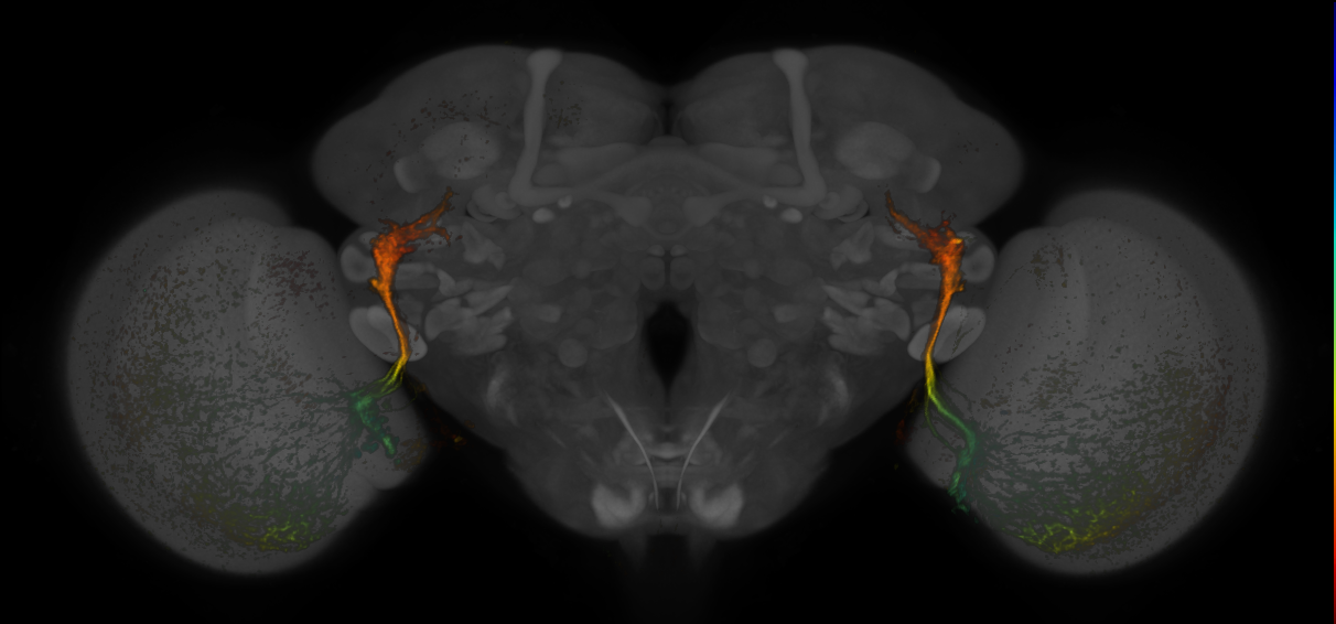JRC_MB425B_Brain_20170829_34_D2_20x