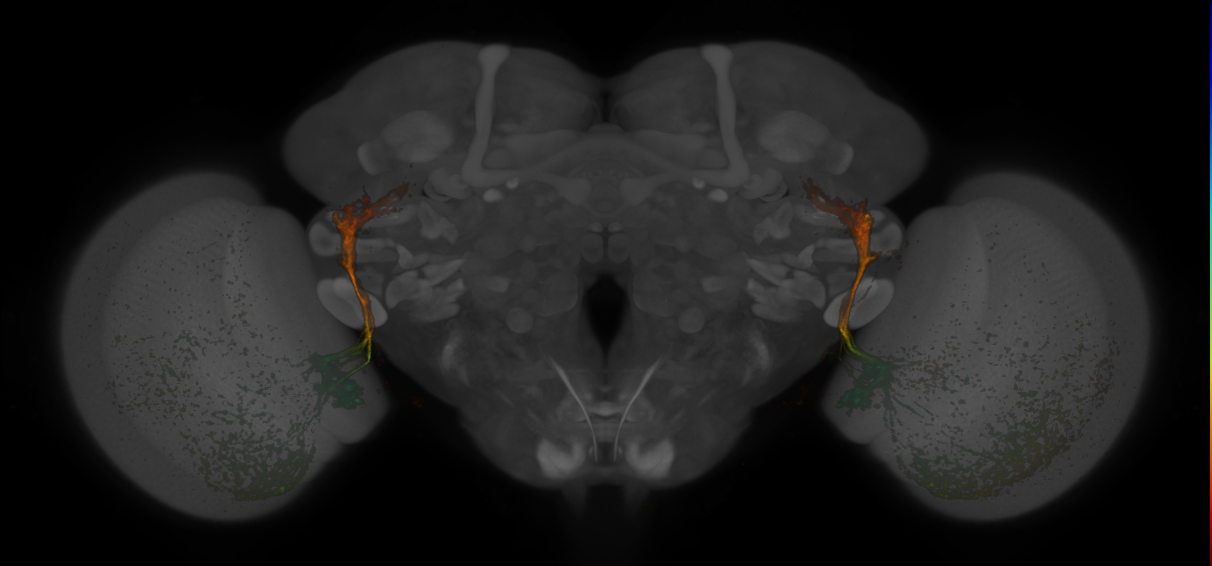 JRC_MB425B_Brain_20170829_34_D3_20x