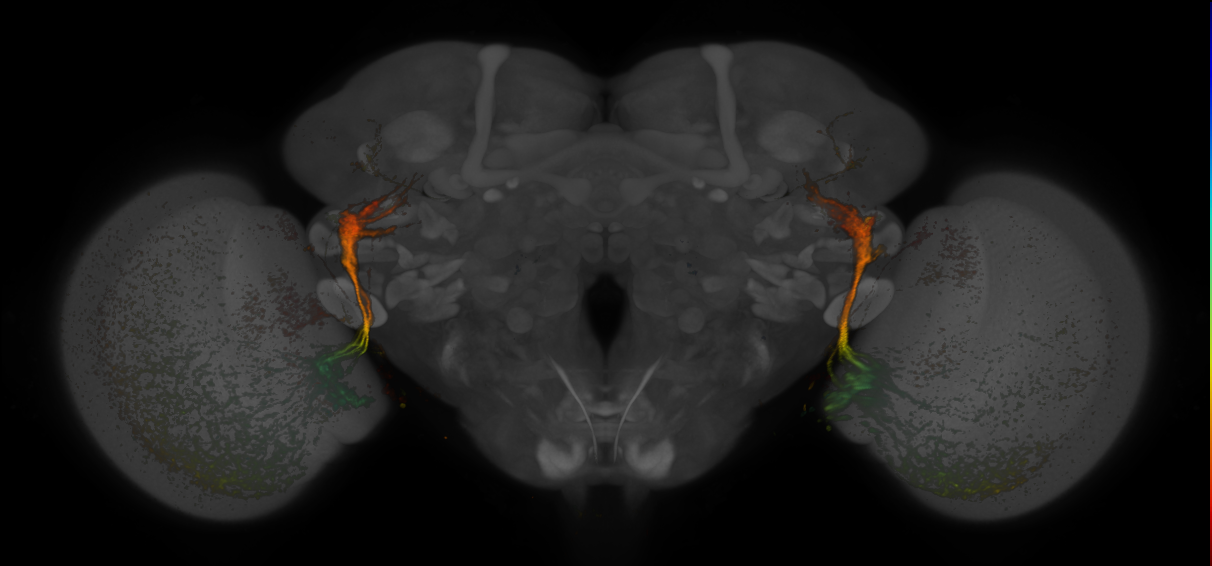 JRC_MB425B_Brain_20170829_34_D4_20x