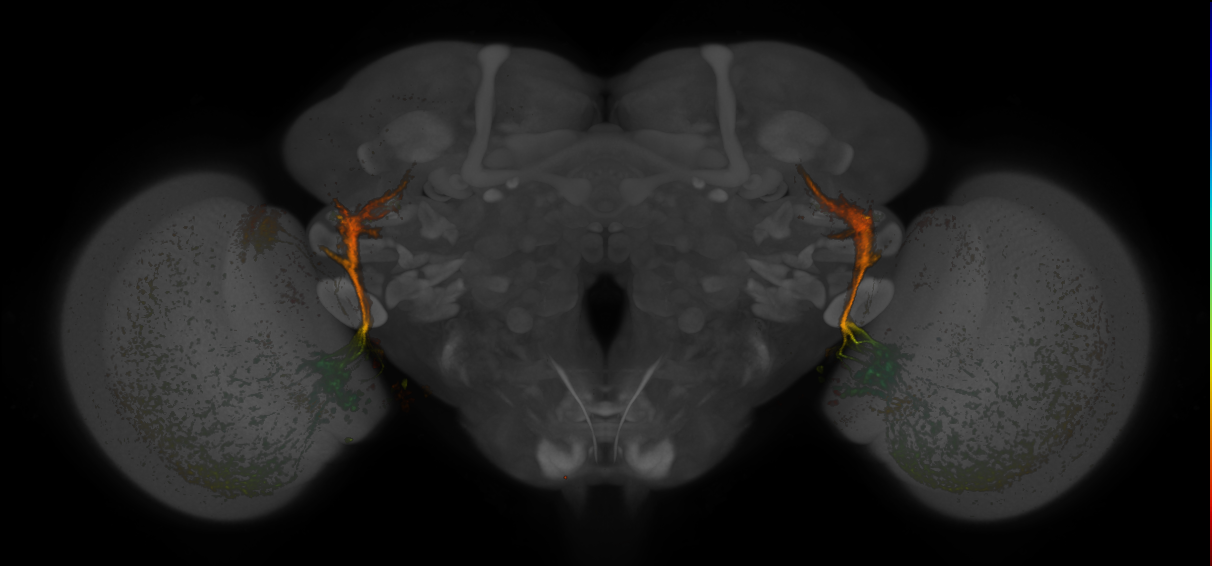 JRC_MB425B_Brain_20170829_34_D5_20x