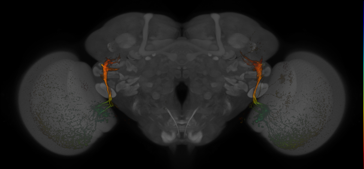 JRC_MB425B_Brain_20170829_34_D6_20x