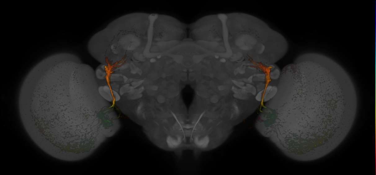 JRC_MB425B_Brain_20170829_34_C3_63x