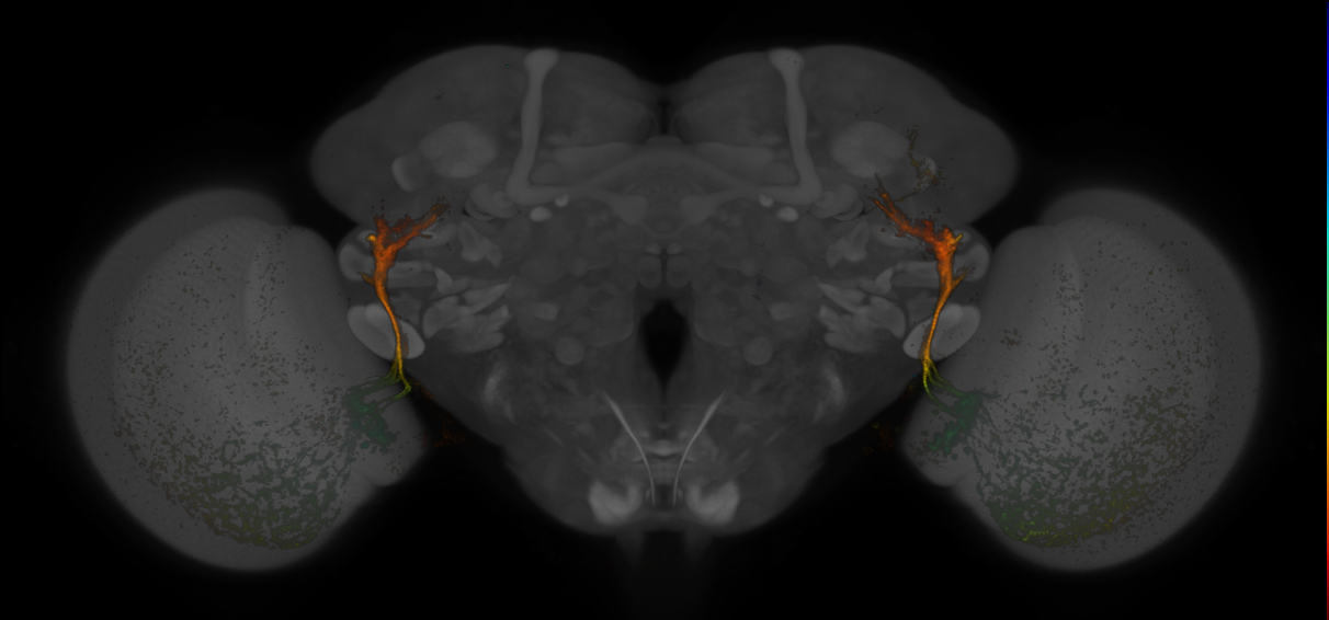 JRC_MB425B_Brain_20170829_34_D1_63x