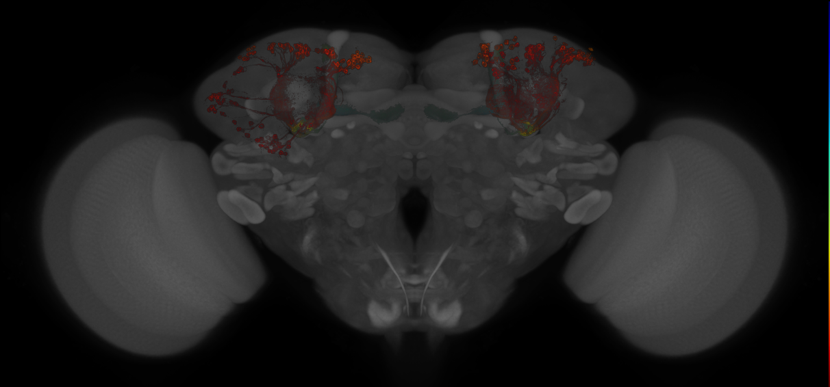 JRC_MB611B_Brain_20130211_32_A1_20x