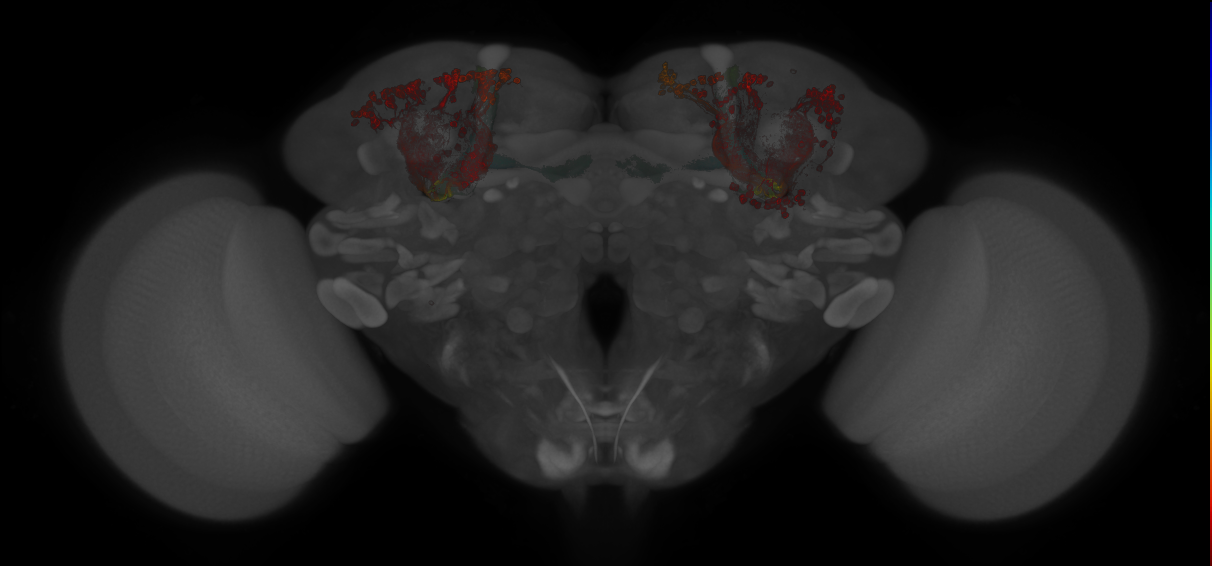 JRC_MB611B_Brain_20130211_32_A5_20x