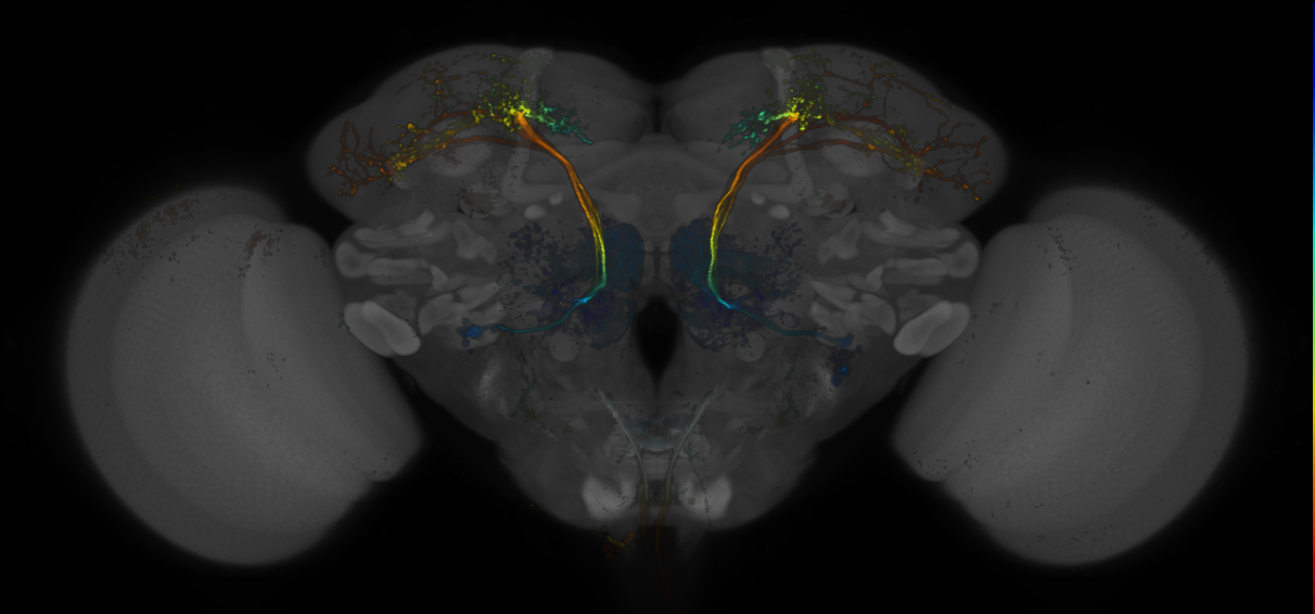 JRC_MB390B_Brain_20170705_32_C6_20x