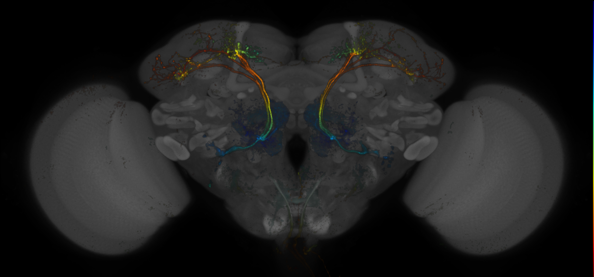 JRC_MB390B_Brain_20170705_32_D1_20x