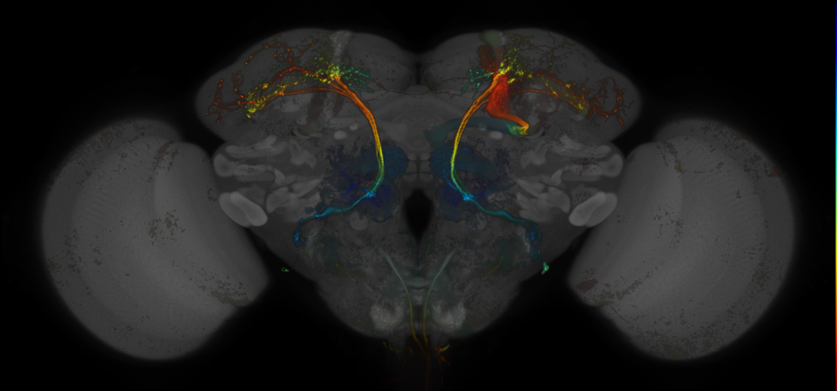 JRC_MB390B_Brain_20170705_32_D3_20x