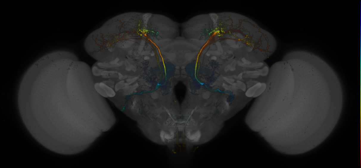 JRC_MB390B_Brain_20170705_32_D4_20x