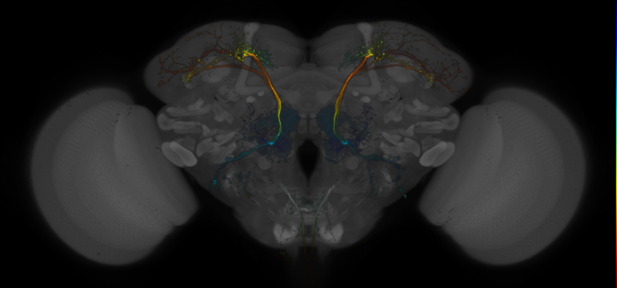 JRC_MB390B_Brain_20170705_32_D5_20x