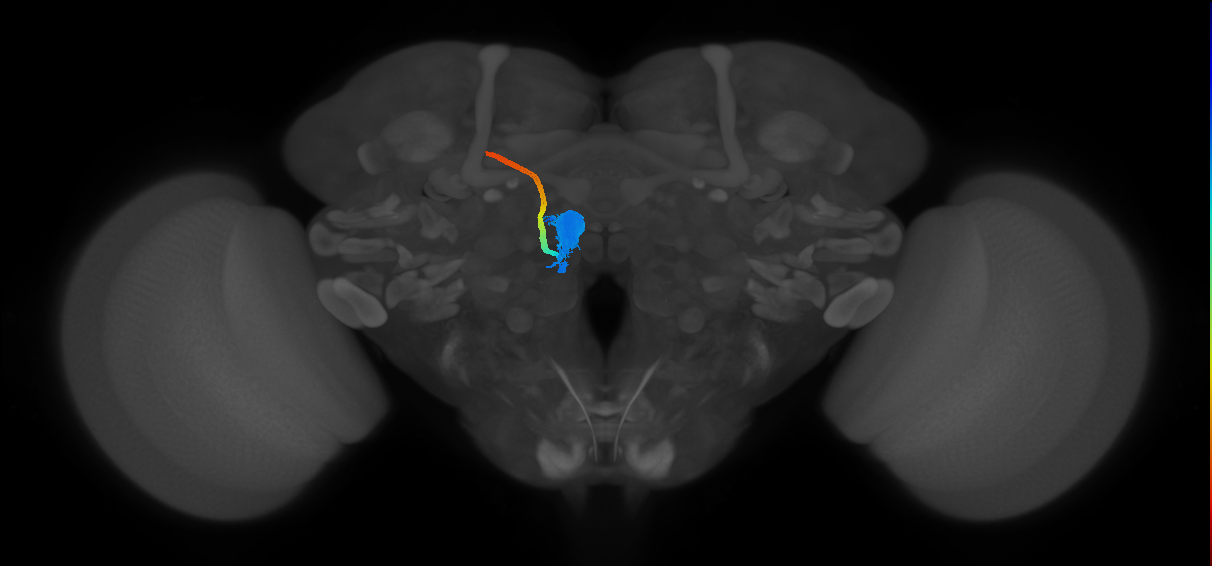 DM1_lPN_L
