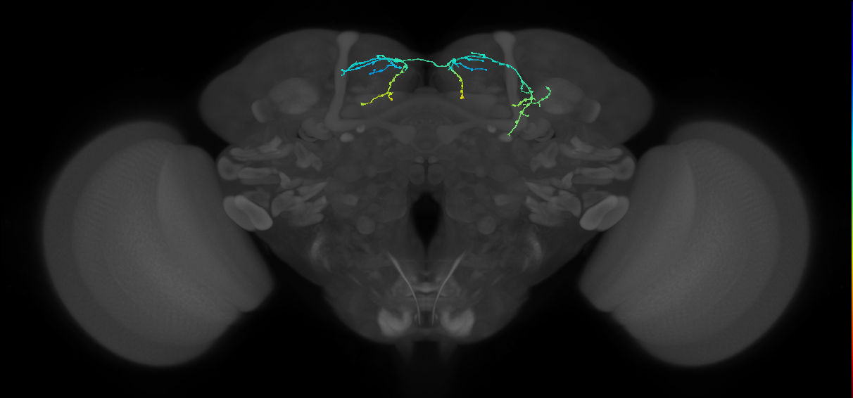 adult doublesex pC1d (female) neuron