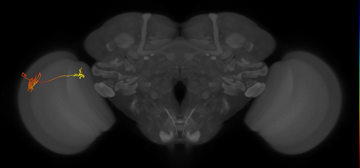 Tm_unclear_L (MaleCNS:60085)