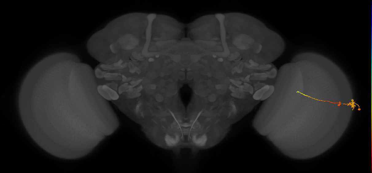 Tm4_R (MaleCNS:69656)