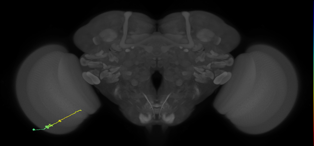 Tm2_L (MaleCNS:539951)