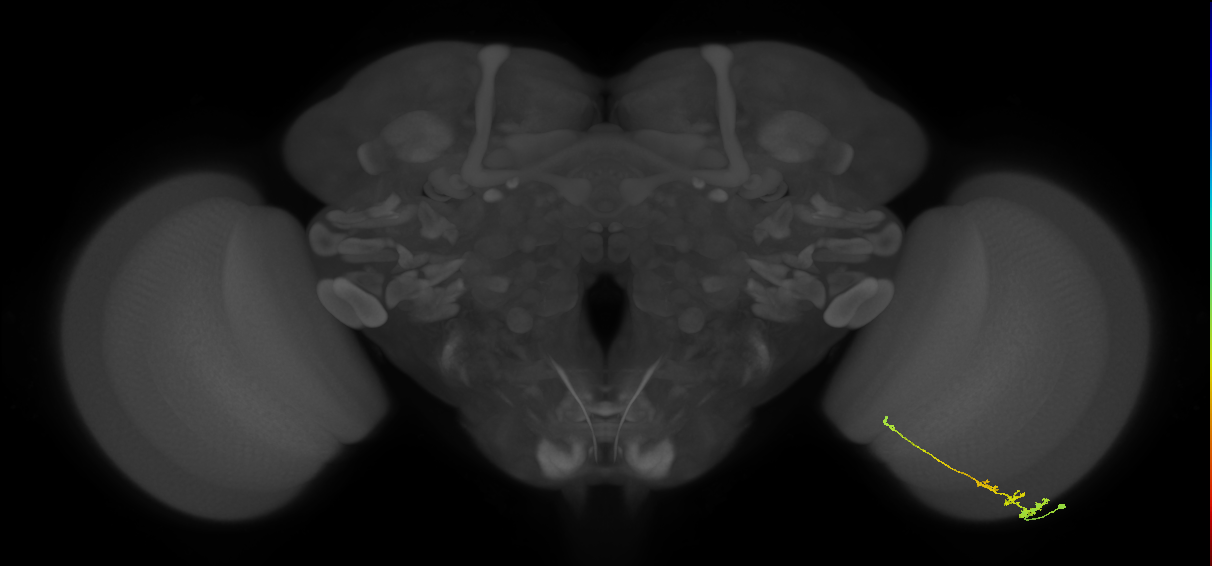 Tm3_R (MaleCNS:75911)