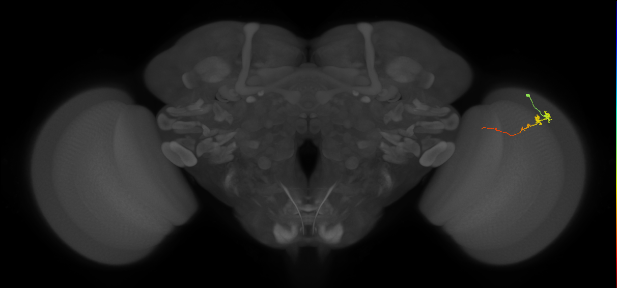 Tm3_R (MaleCNS:92465)