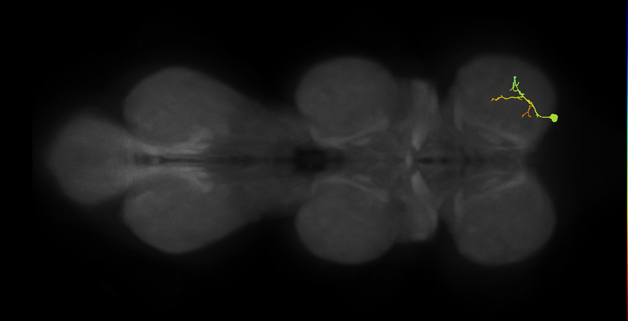 Ta depressor MN_R (MaleCNS:1050380236)