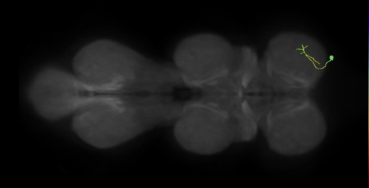 Ta depressor MN_R (MaleCNS:1050815462)