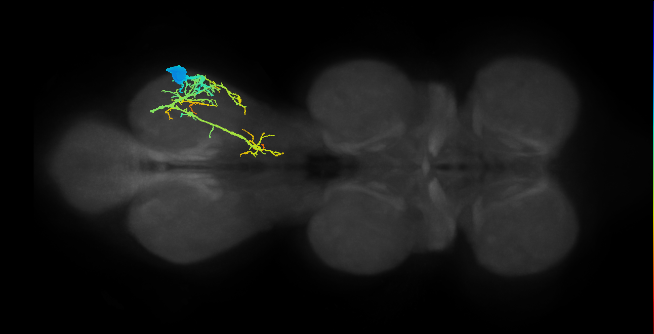 Ti extensor MN_R (MaleCNS:809935)