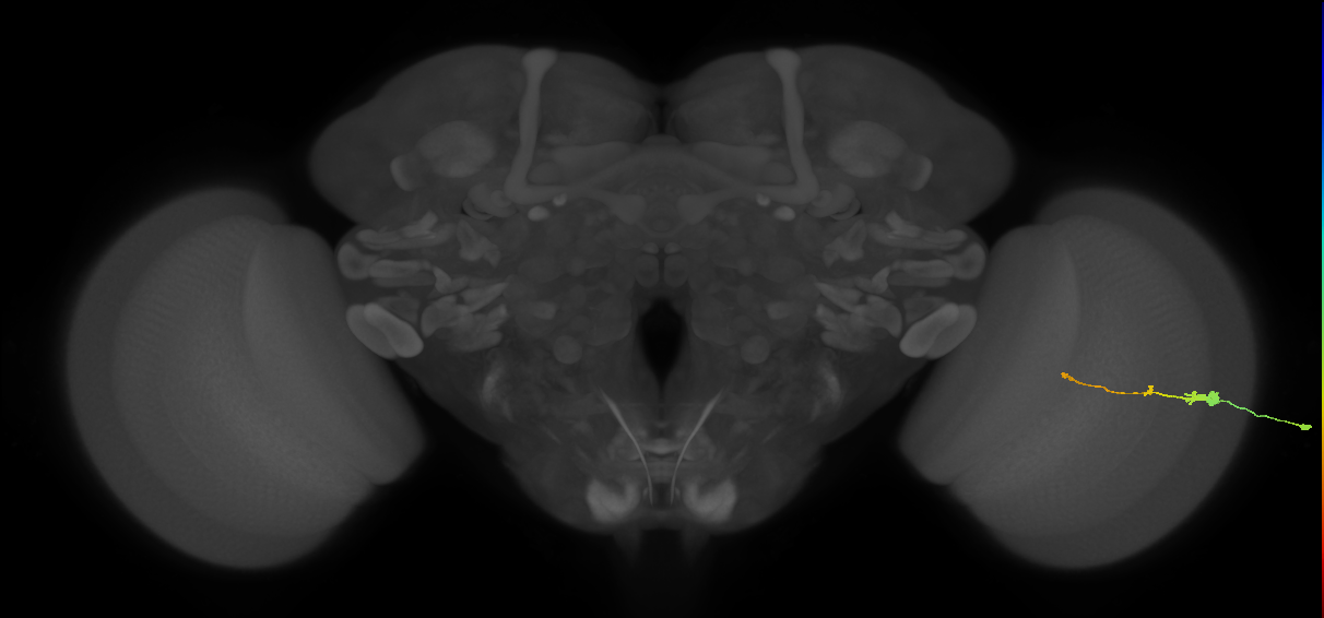 Tm2_R (MaleCNS:78825)