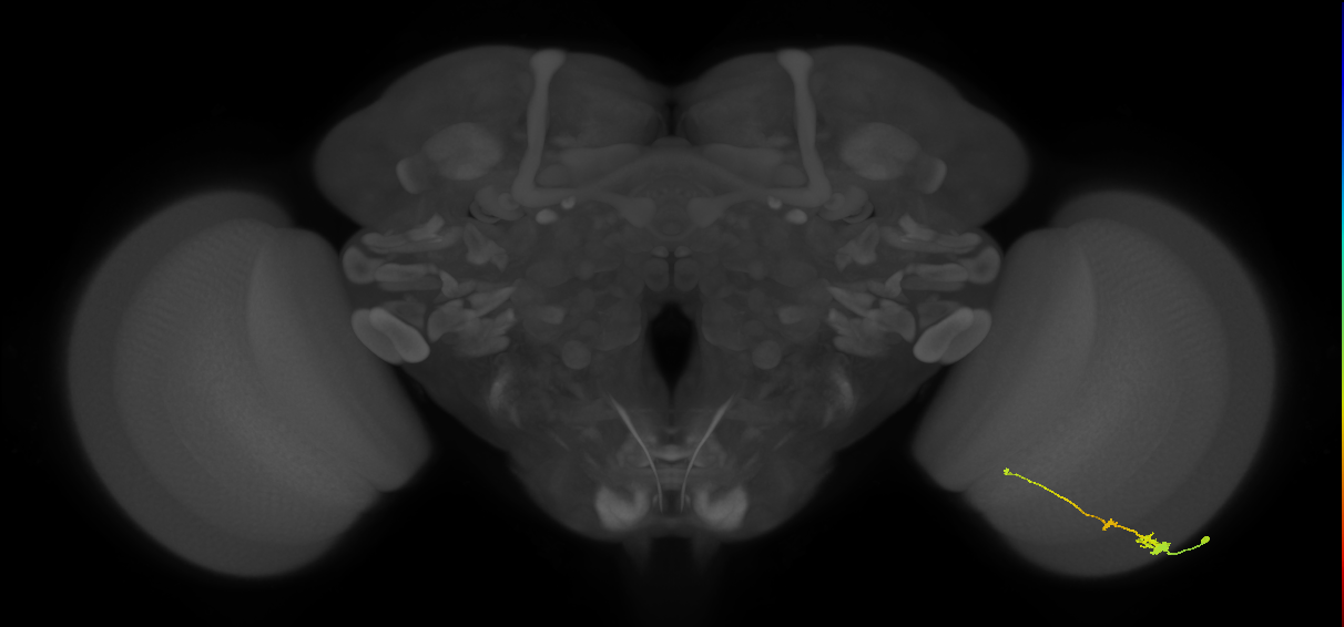 Tm2_R (MaleCNS:53544)