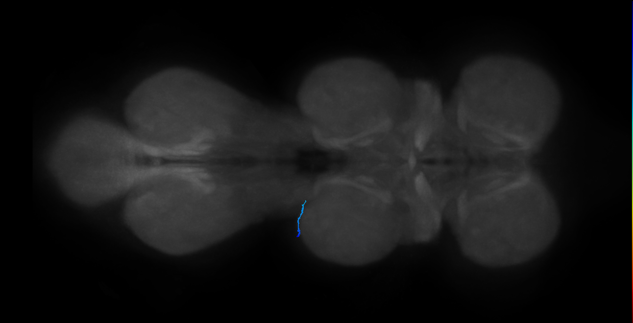 mechanosensory neuron of hair plate