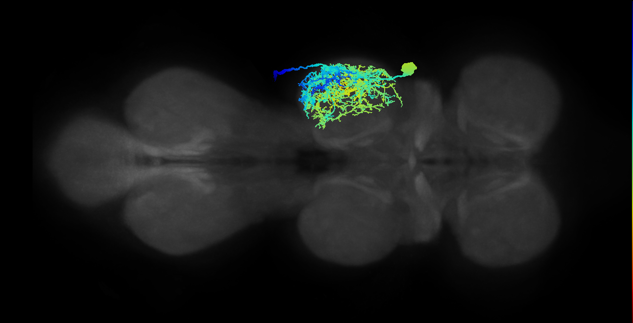 Sternal anterior rotator MN_R (MaleCNS:801946)