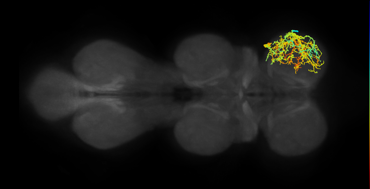 Sternal posterior rotator MN_R (MaleCNS:805410)