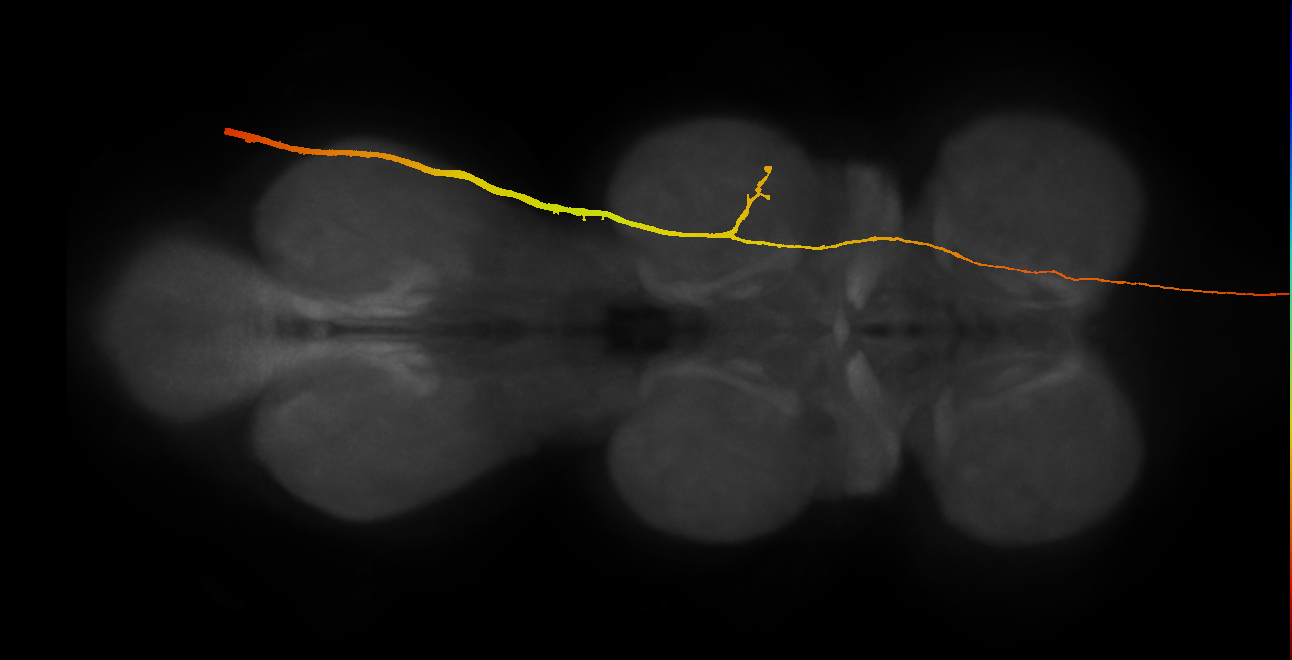 eo neuron