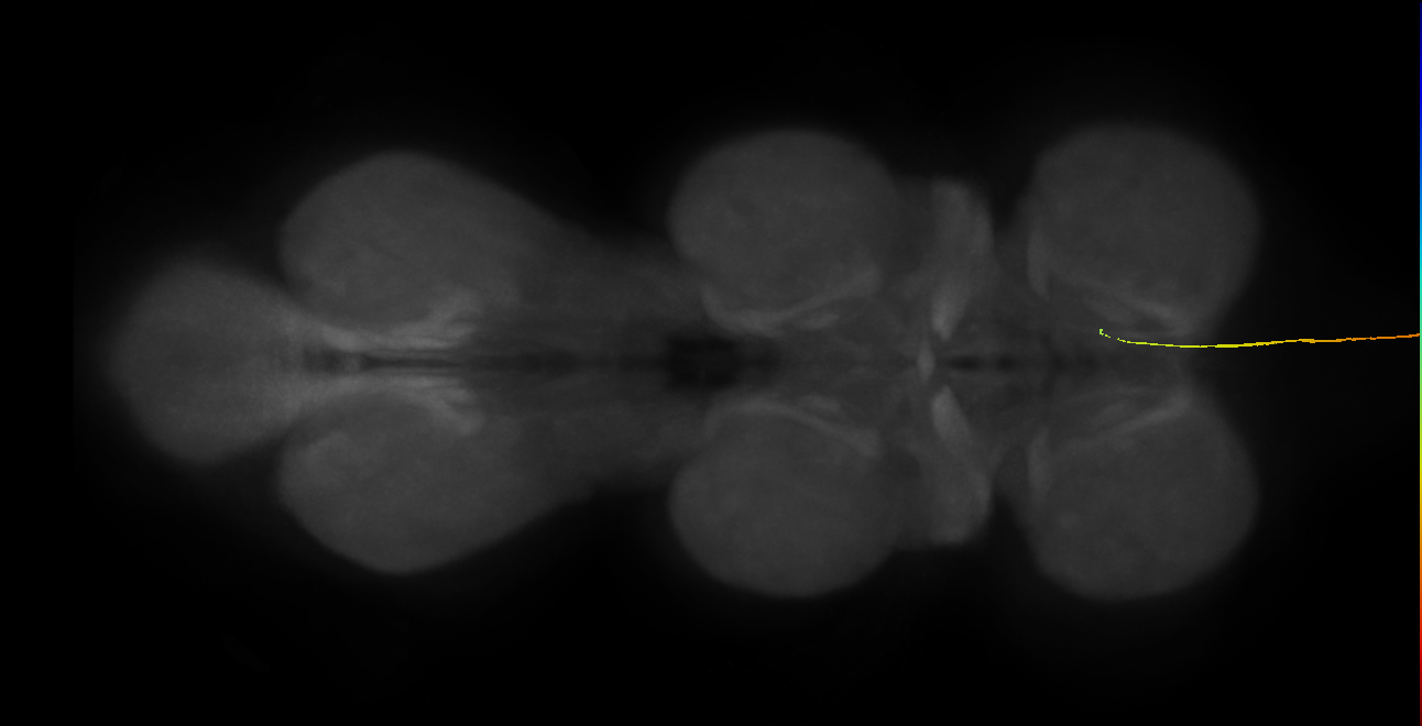 SApp23_R (MaleCNS:262161)
