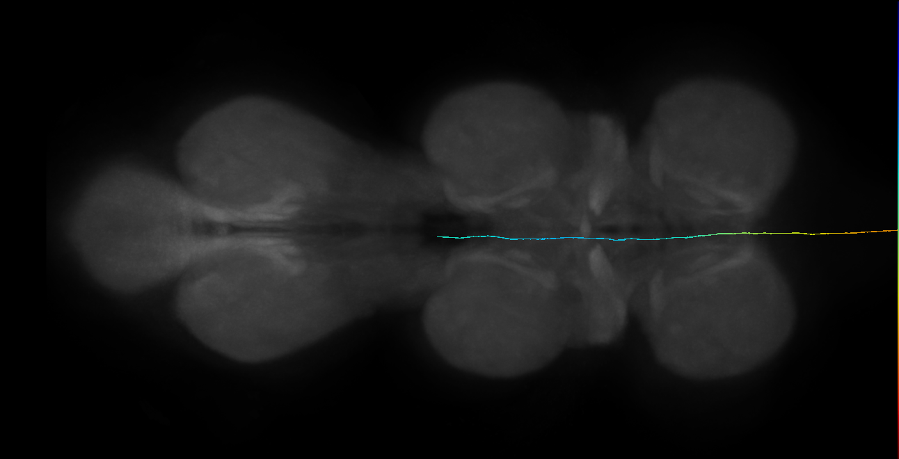 LgAG1_L (MaleCNS:130347)