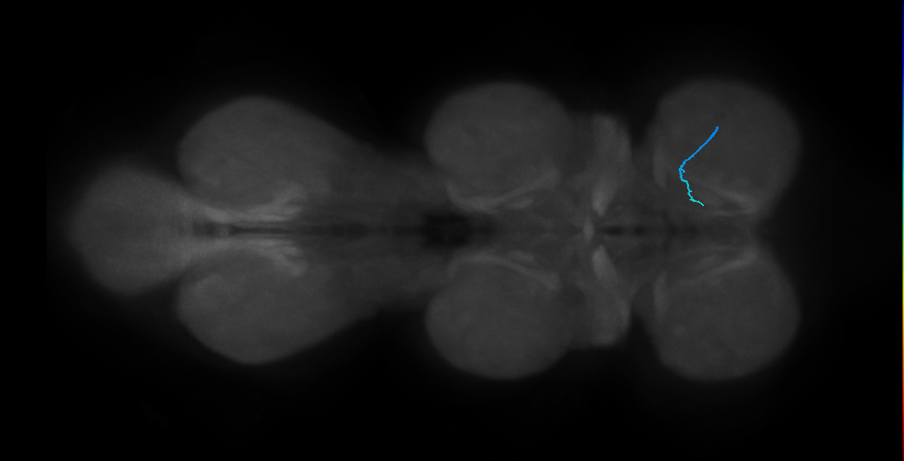 LgLG1a_R (MaleCNS:823278)