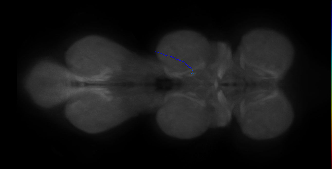 LgLG1b_R (MaleCNS:828914)