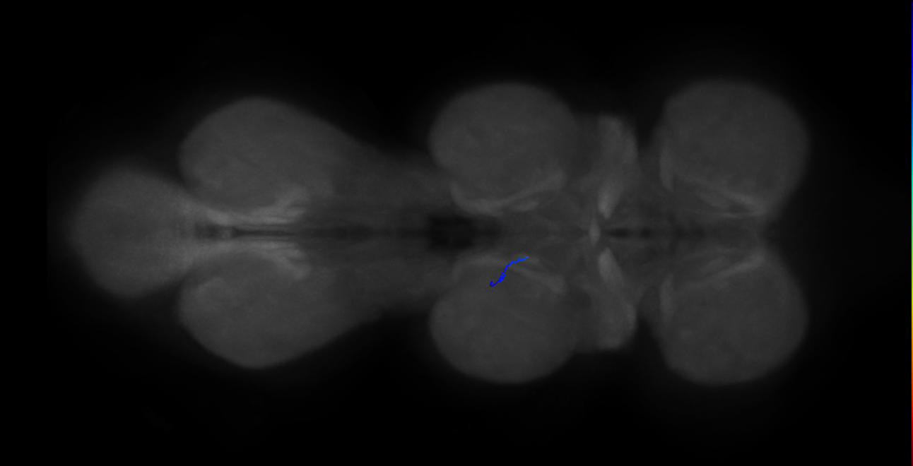 LgLG4_L (MaleCNS:827154)
