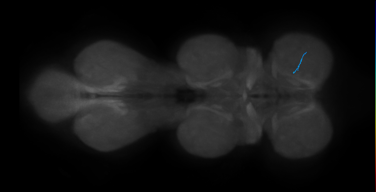 LgLG4_R (MaleCNS:1050190015)