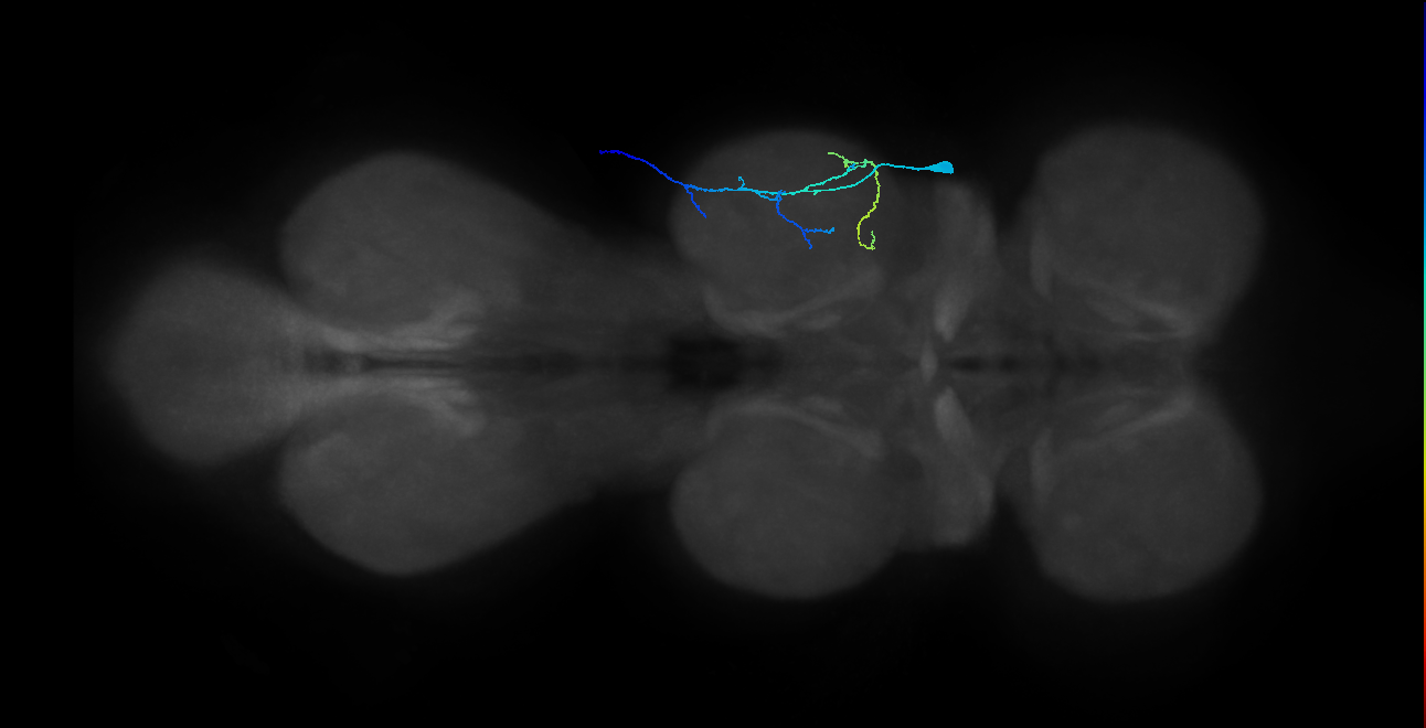 MNml76_R (MaleCNS:1050160593)