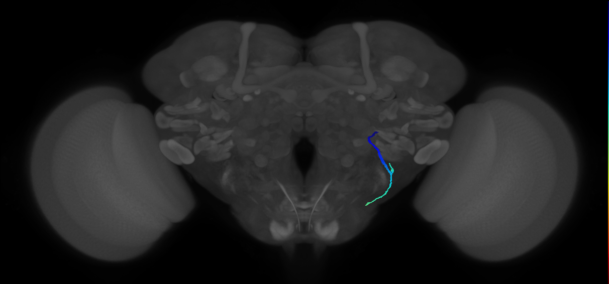 auditory sensory neuron