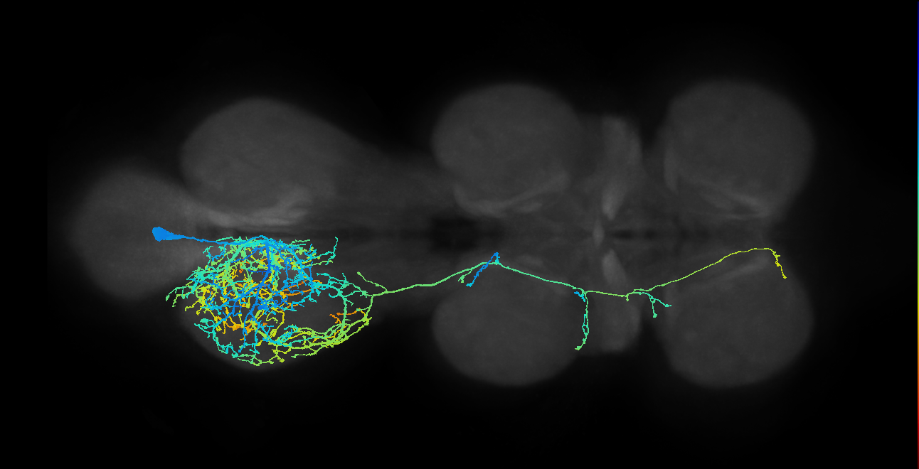 metathoracic neuron